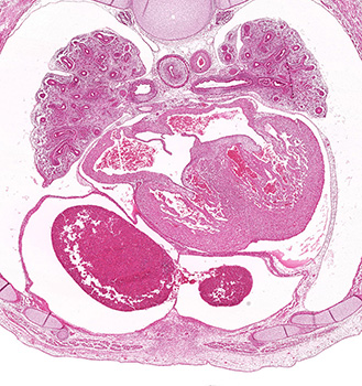 A histology section of a human embryo