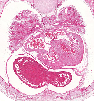 A histology section of a human embryo