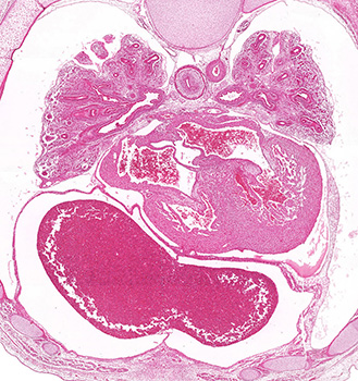 A histology section of a human embryo