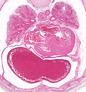 A histology section of a human embryo