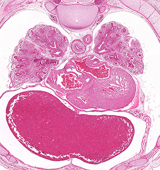 A histology section of a human embryo