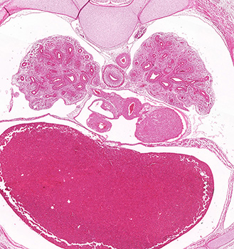 A histology section of a human embryo