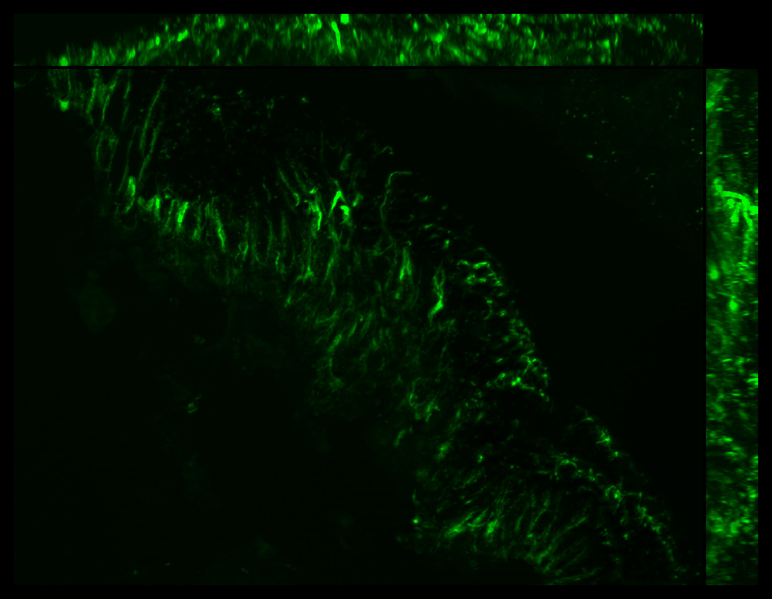 Gene expression in the human fetal eye