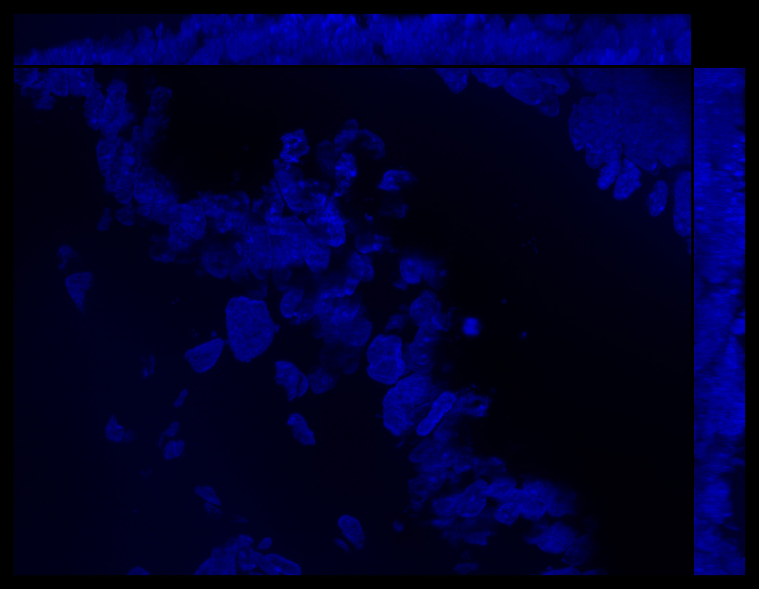 Gene expression in the human fetal eye
