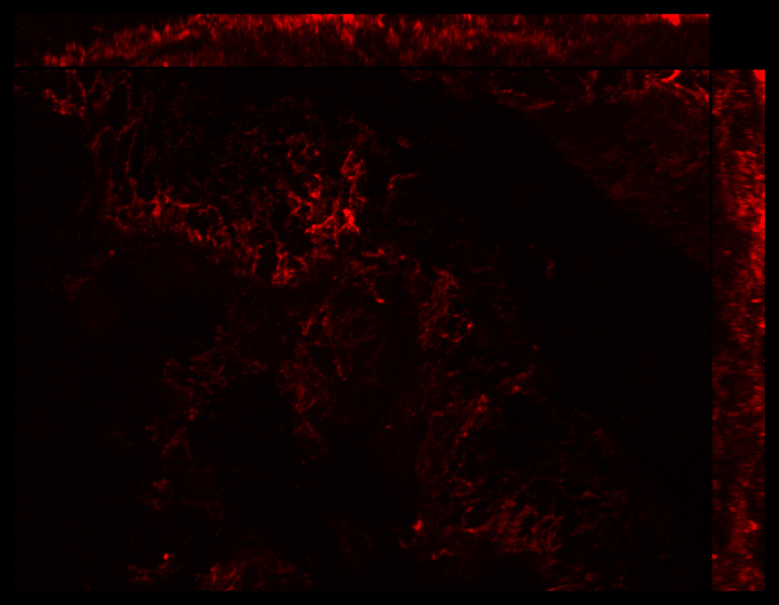 Gene expression in the human fetal eye