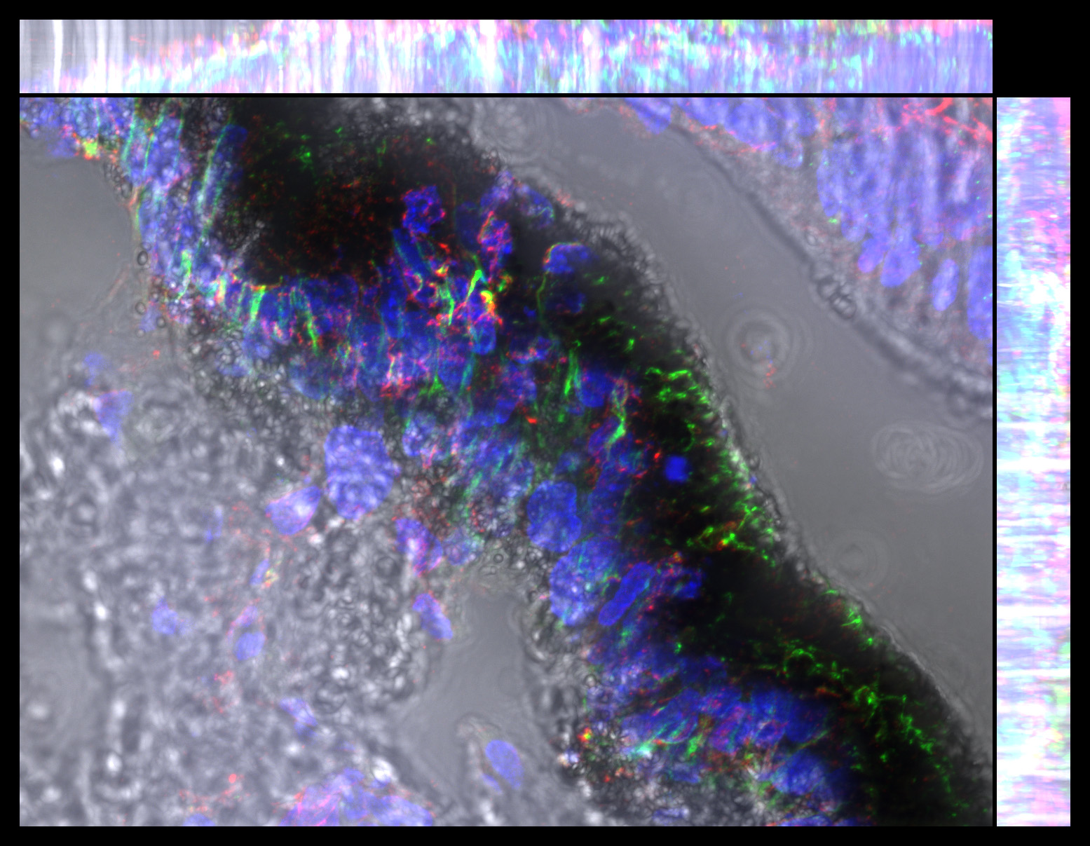Gene expression in the human fetal eye