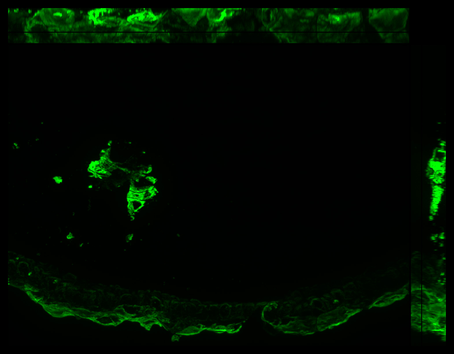 Gene expression in the human fetal eye