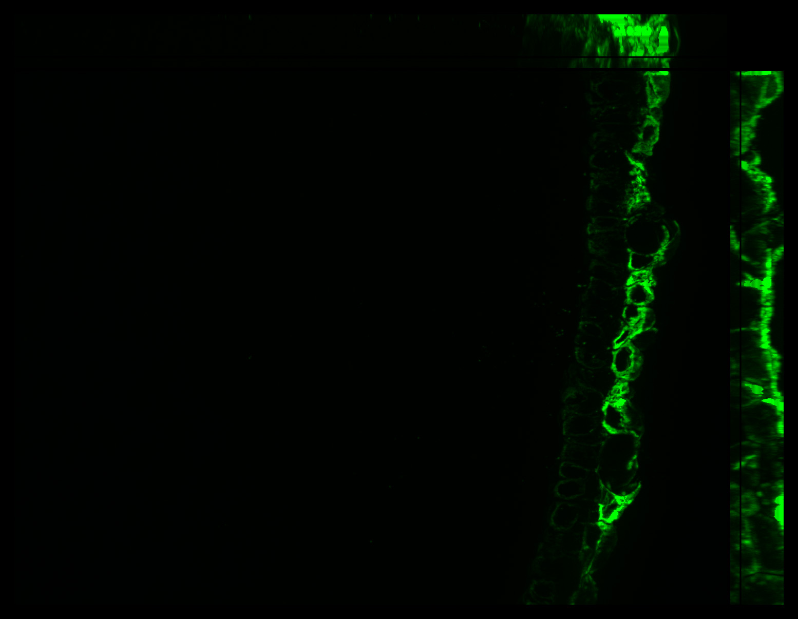 Gene expression in the human fetal eye