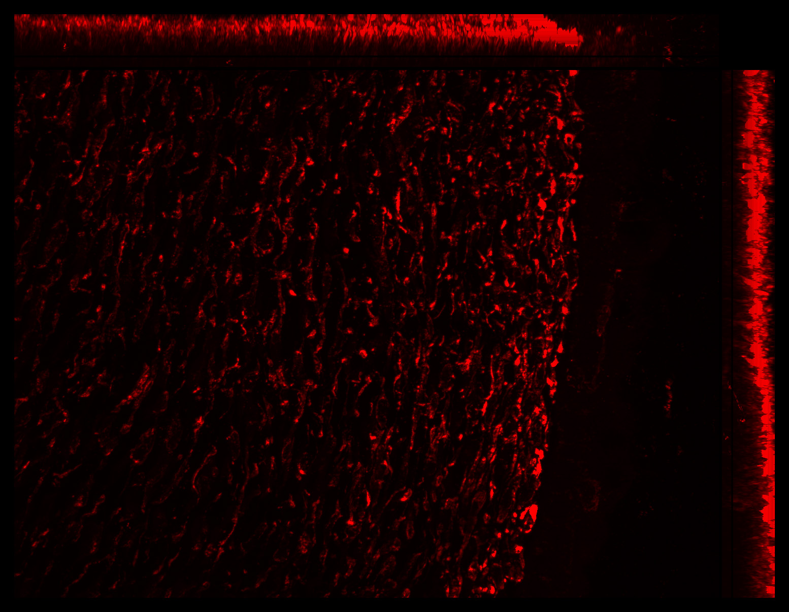 Gene expression in the human fetal eye