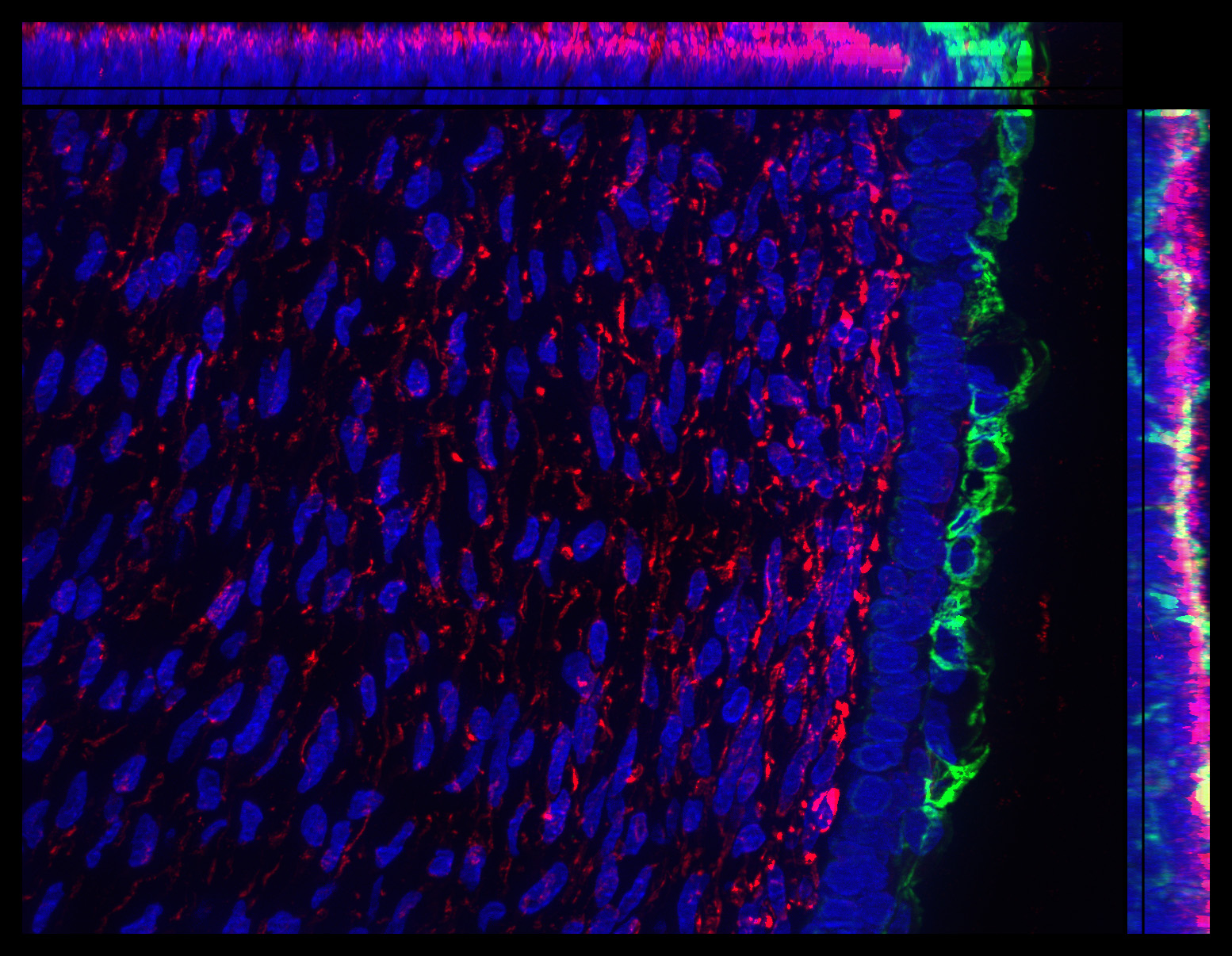 Gene expression in the human fetal eye