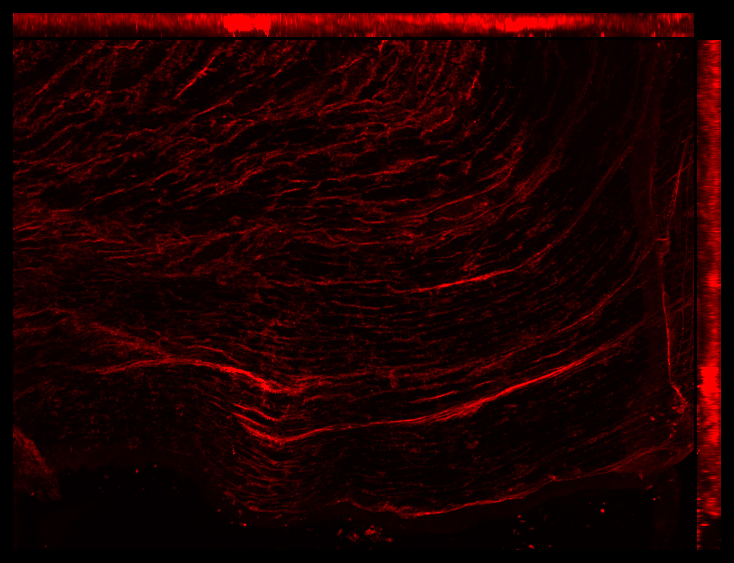 Gene expression in the human fetal eye