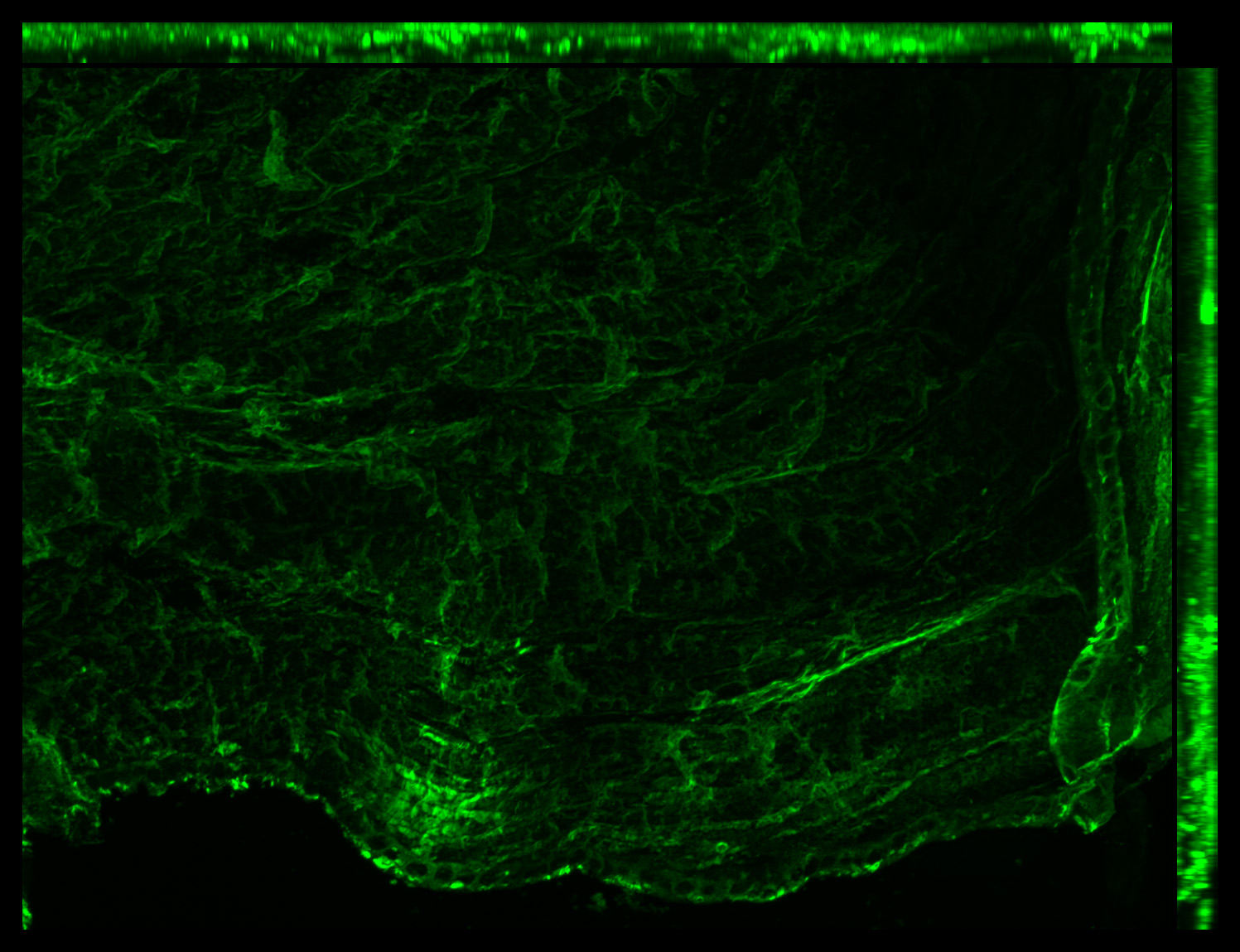 Gene expression in the human fetal eye