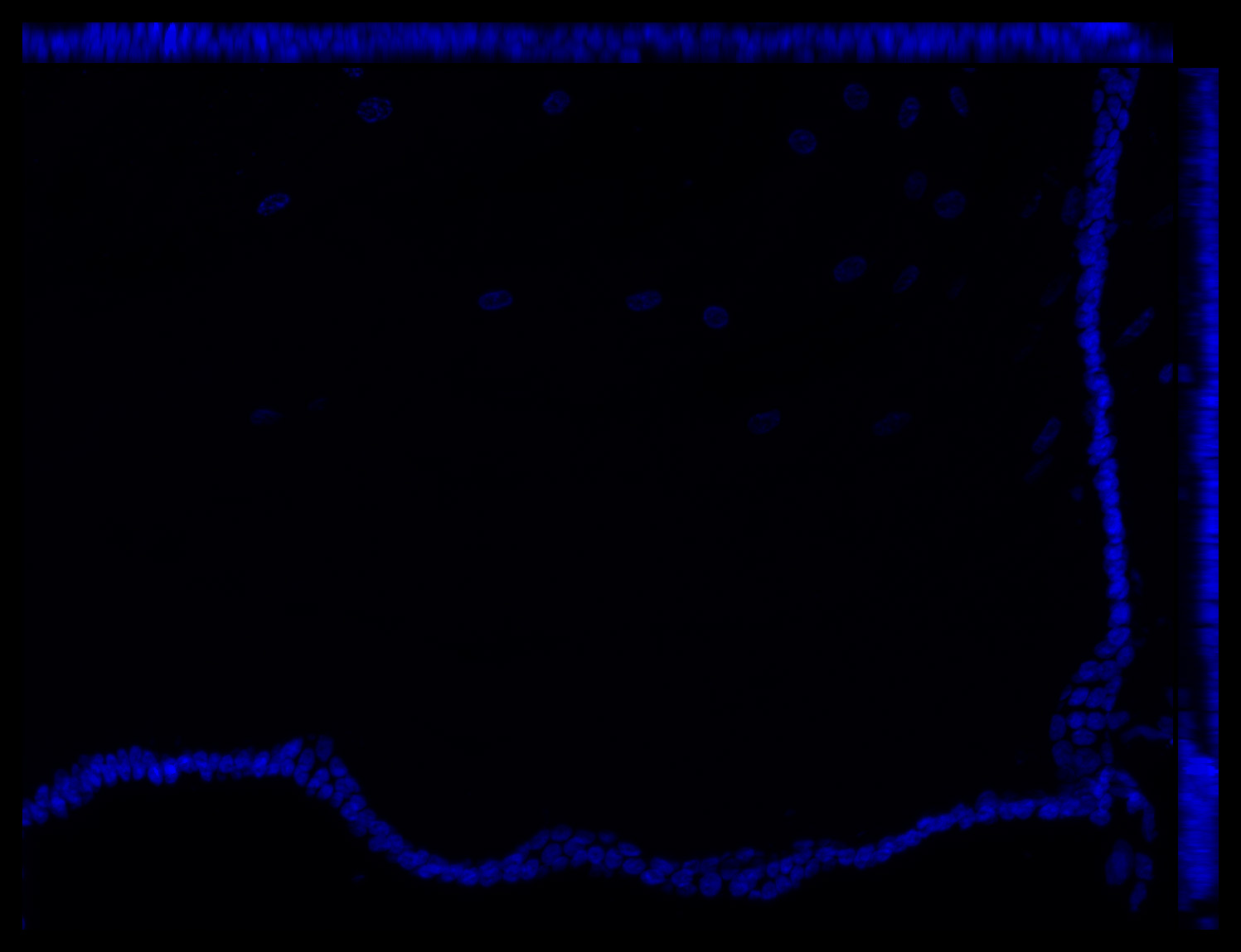 Gene expression in the human fetal eye