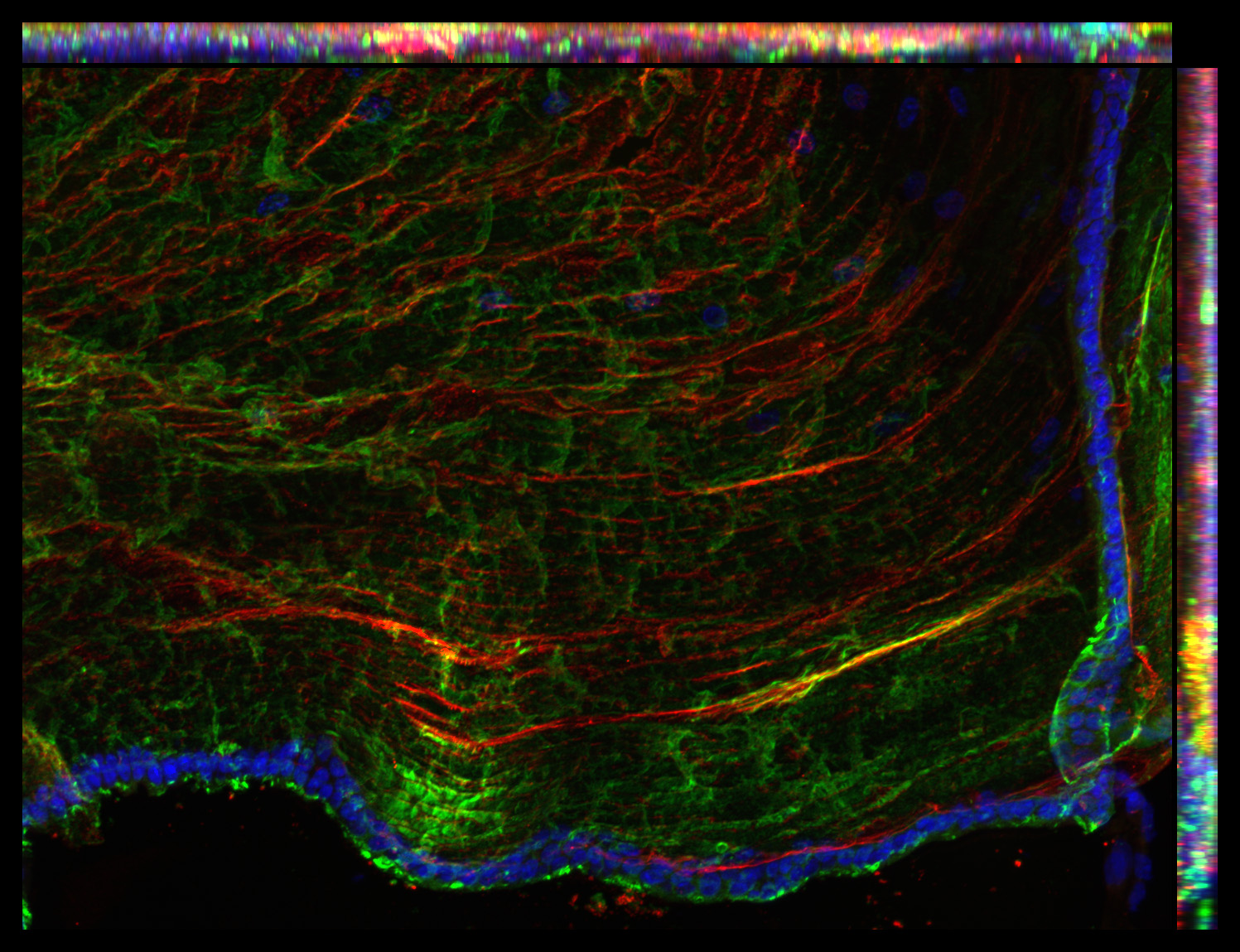 Gene expression in the human fetal eye