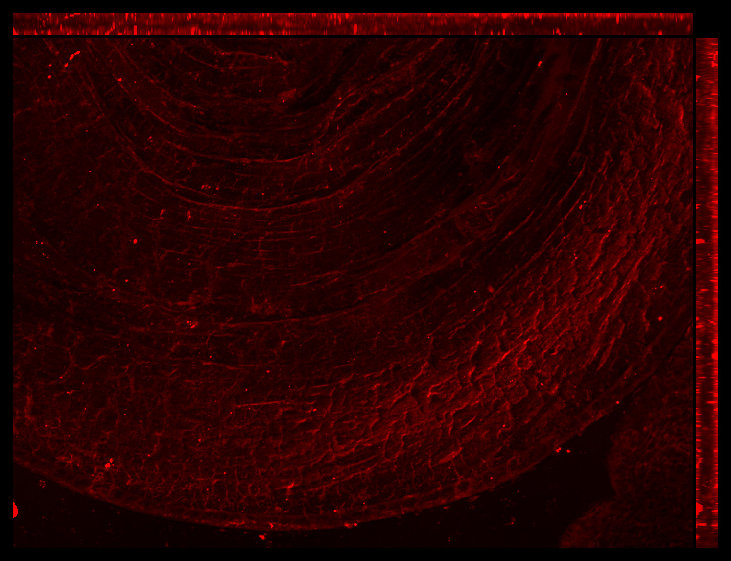 Gene expression in the human fetal eye