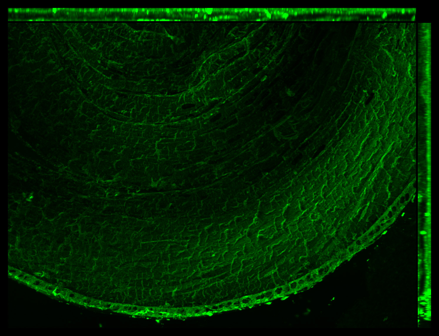 Gene expression in the human fetal eye
