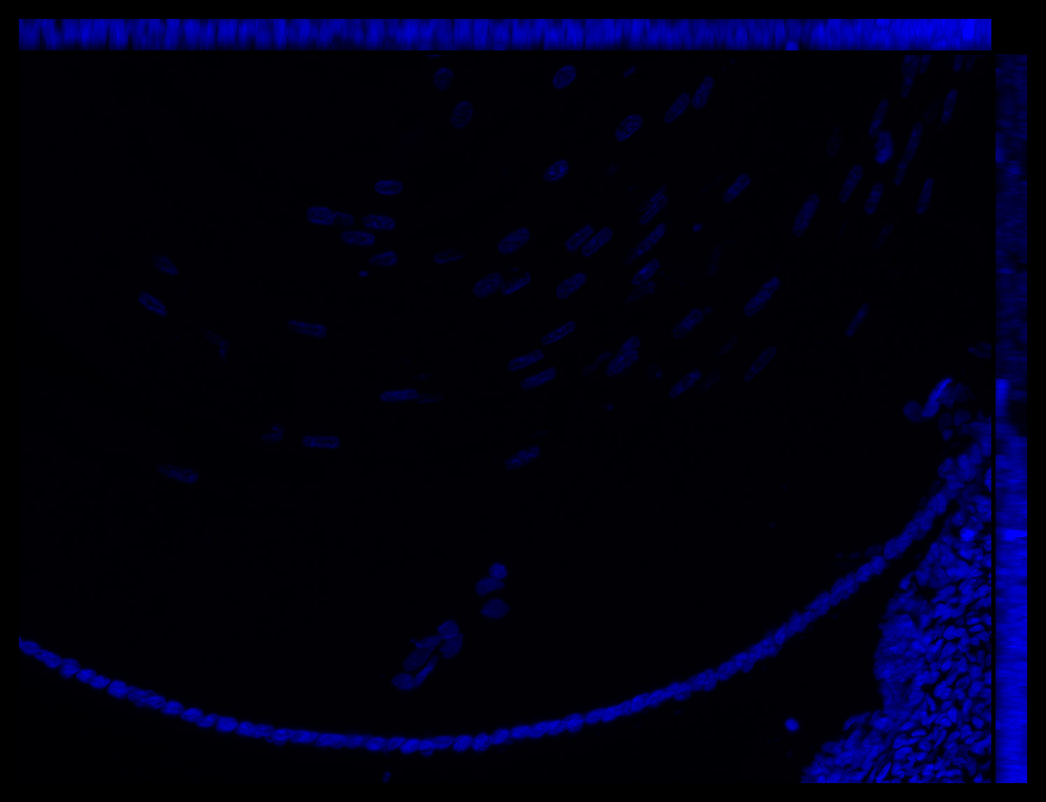 Gene expression in the human fetal eye