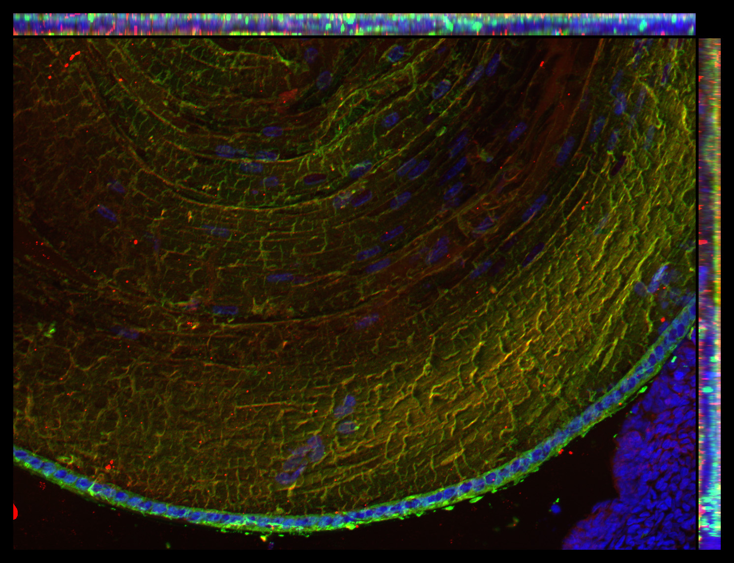 Gene expression in the human fetal eye