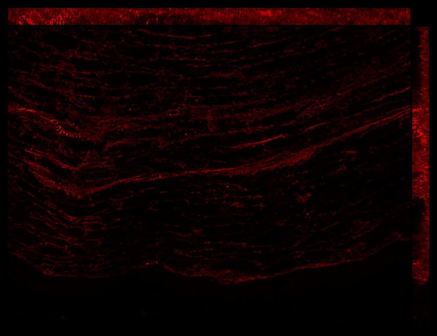 Gene expression in the human fetal eye