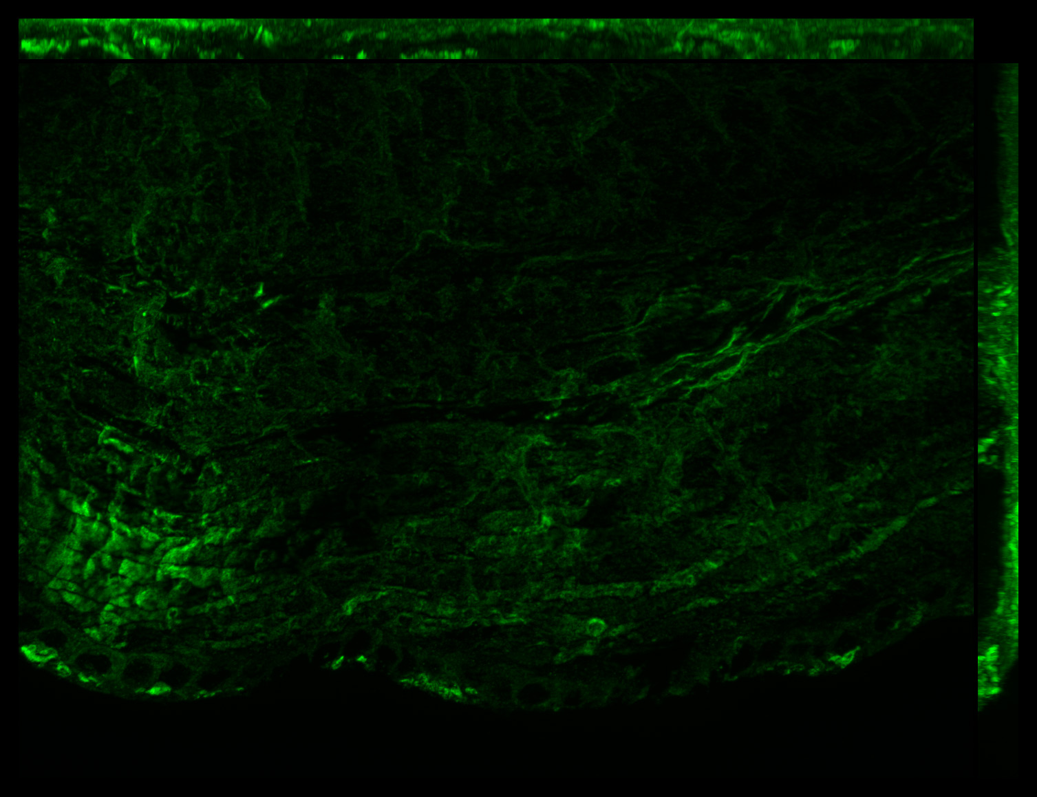 Gene expression in the human fetal eye
