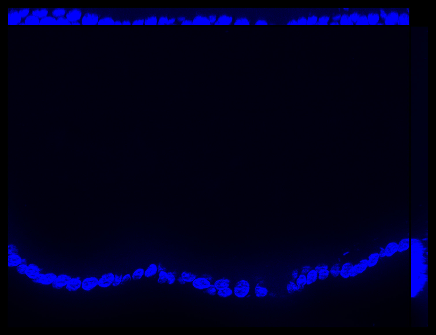 Gene expression in the human fetal eye