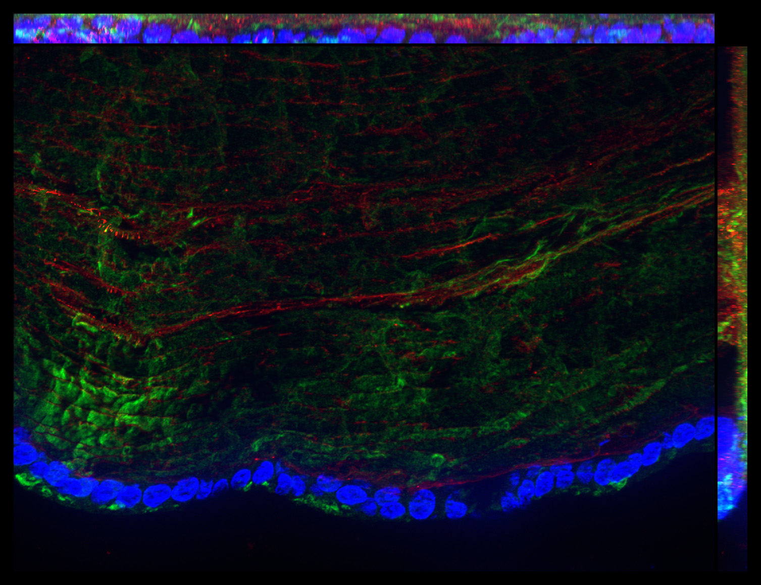 Gene expression in the human fetal eye