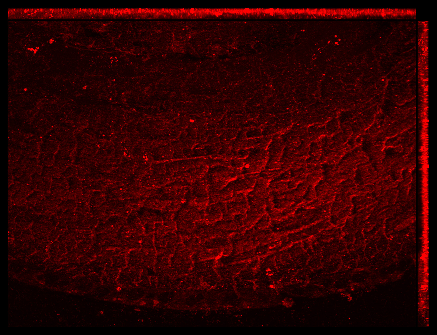 Gene expression in the human fetal eye