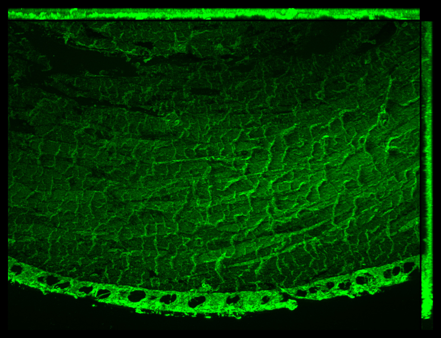 Gene expression in the human fetal eye