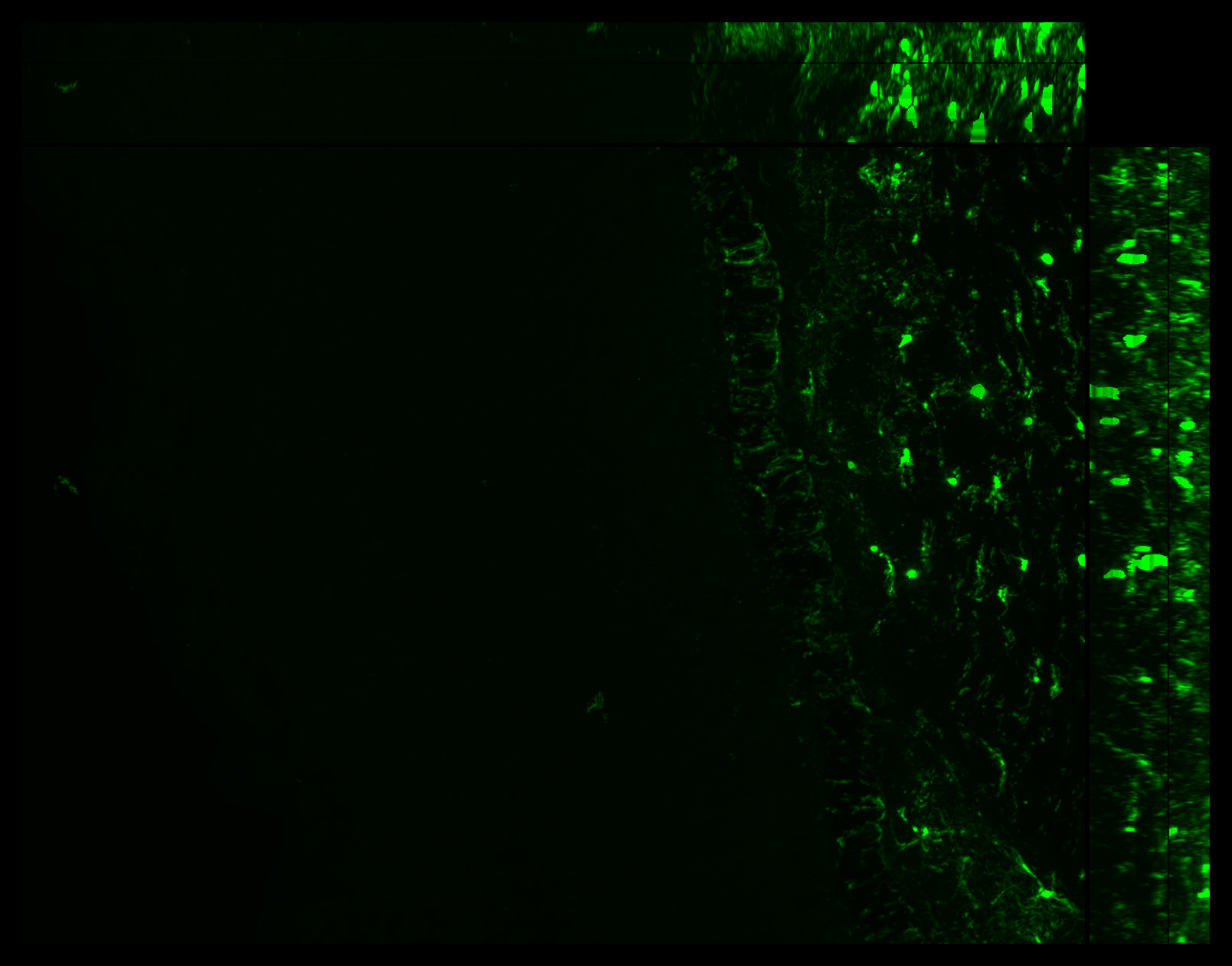 Gene expression in the human fetal eye