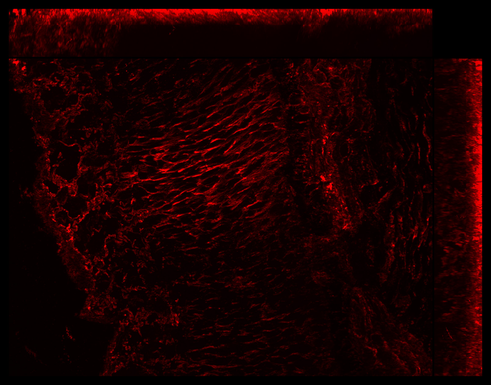 Gene expression in the human fetal eye