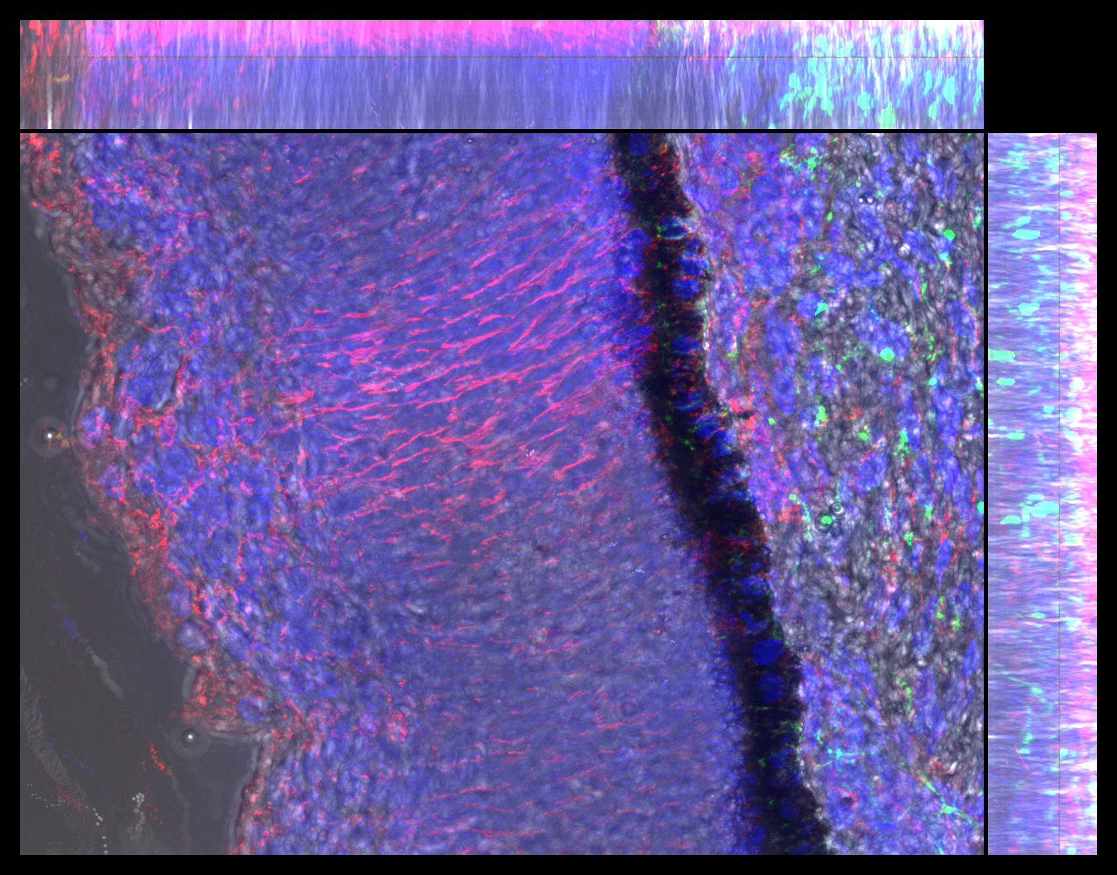 Gene expression in the human fetal eye