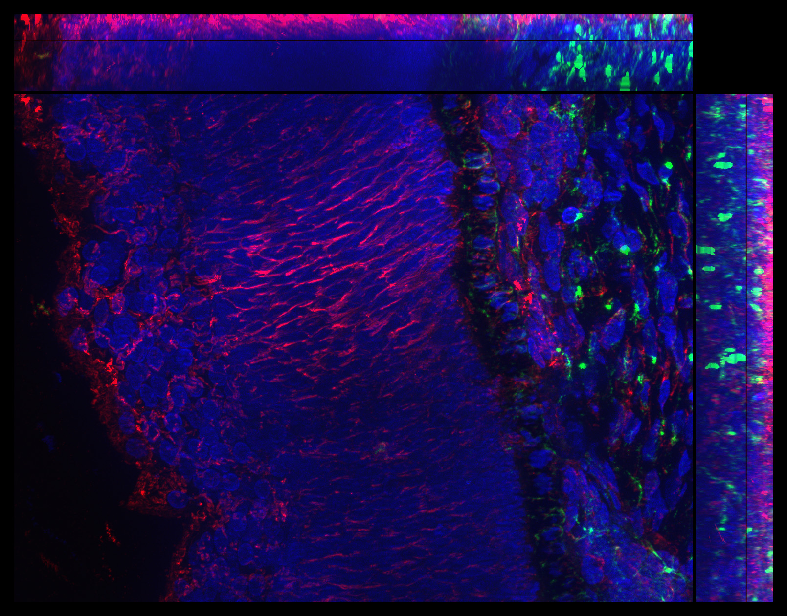 Gene expression in the human fetal eye