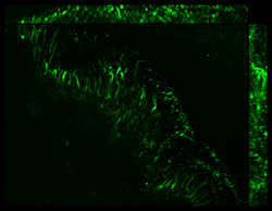 Gene expression in the human fetal eye