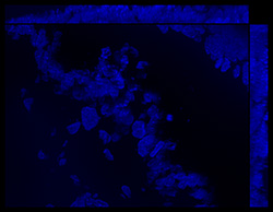 Gene expression in the human fetal eye