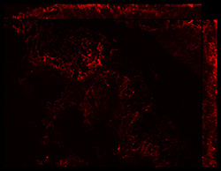 Gene expression in the human fetal eye