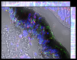 Gene expression in the human fetal eye