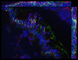 Gene expression in the human fetal eye