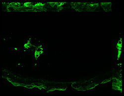 Gene expression in the human fetal eye