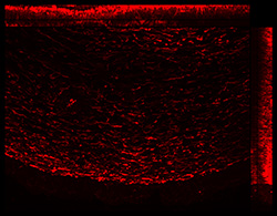 Gene expression in the human fetal eye