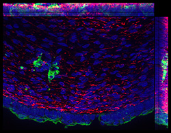 Gene expression in the human fetal eye
