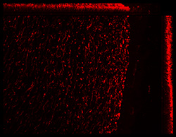 Gene expression in the human fetal eye