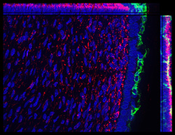 Gene expression in the human fetal eye