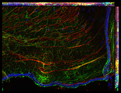Gene expression in the human fetal eye