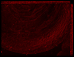Gene expression in the human fetal eye