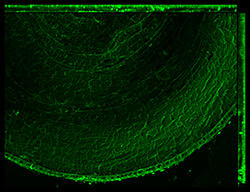 Gene expression in the human fetal eye
