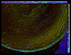 Gene expression in the human fetal eye