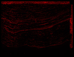 Gene expression in the human fetal eye