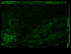 Gene expression in the human fetal eye