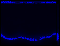 Gene expression in the human fetal eye