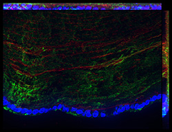 Gene expression in the human fetal eye